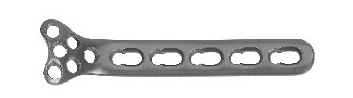 Блокуюча пластина для голівки променевої кістки UMP